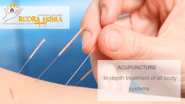 Acupuncture
